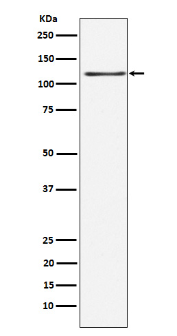 KSR1 Rabbit mAb