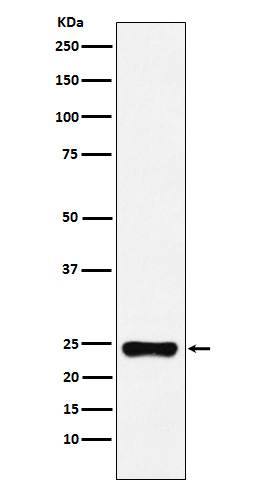 BAG2 Rabbit mAb