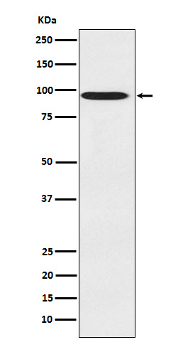 CDT2 Rabbit mAb