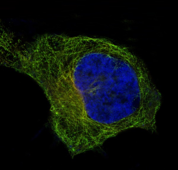 beta I Tubulin Rabbit mAb