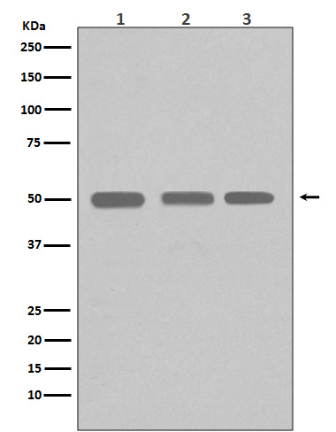 beta I Tubulin Rabbit mAb