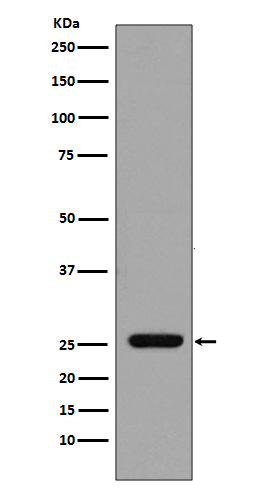 GST Rabbit mAb 