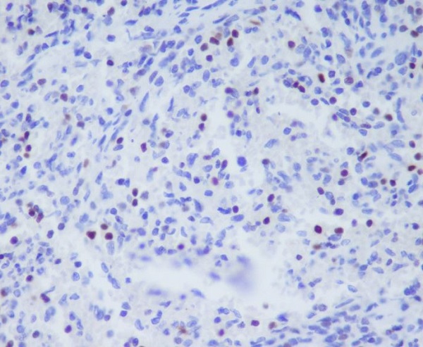 TBX21 Rabbit mAb