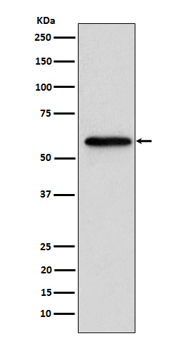 Retinoic Acid Receptor beta Rabbit mAb