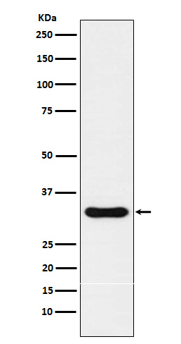 NKX3.1 Rabbit mAb