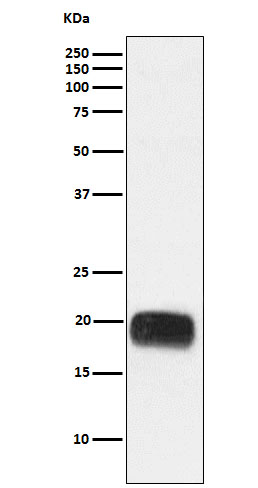 Mammaglobin A Rabbit mAb