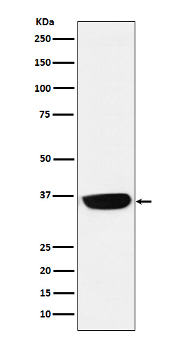 PHOX2B Rabbit mAb