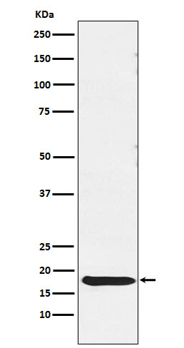 TSH beta Rabbit mAb