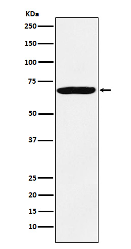 IMP3 Rabbit mAb