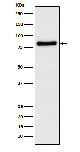 TLE1 Rabbit mAb