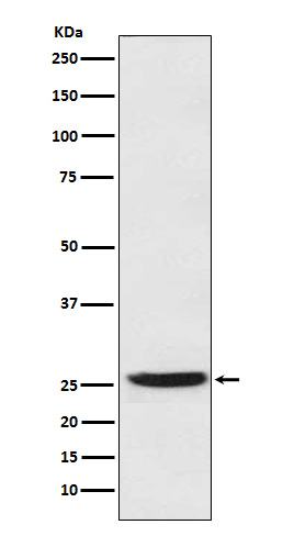 PGDH Rabbit mAb