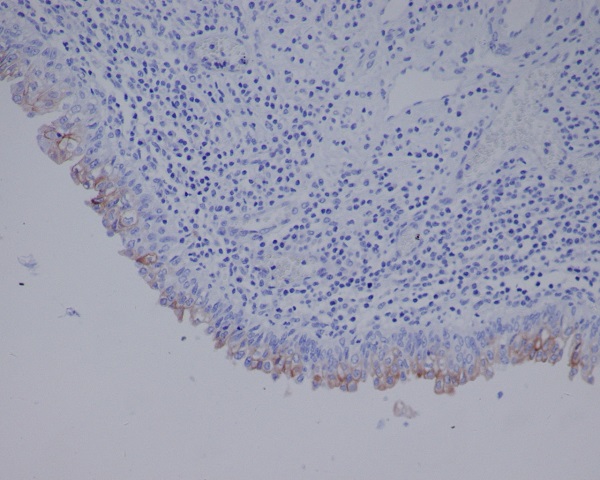 Uroplakin3a Rabbit mAb