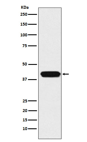 ATOH1 Rabbit mAb