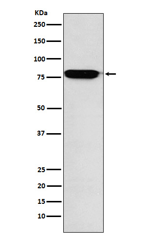 RANK Rabbit mAb