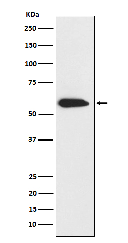 Cytokeratin 6 Rabbit mAb