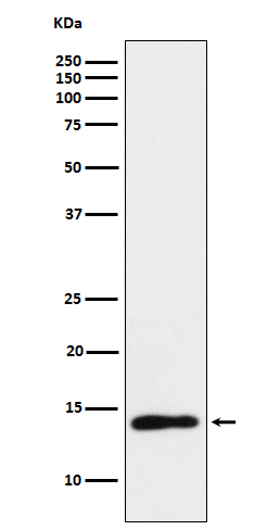 TCL1 Rabbit mAb