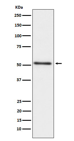 Prostatic Acid Phosphatase Rabbit mAb