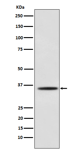 Myogenin Rabbit mAb