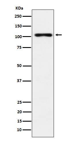 TPO Rabbit mAb