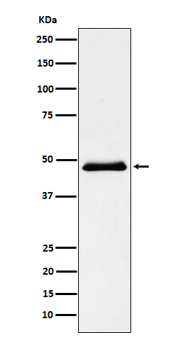 Pancreatic Lipase ��PNLIP�� Rabbit mAb