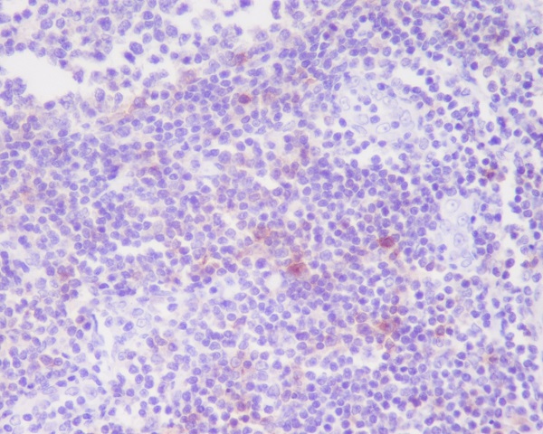 CD25 Rabbit mAb