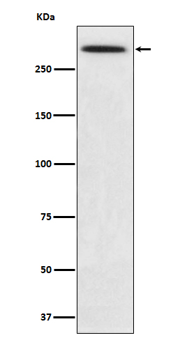 SPTA1 Rabbit mAb