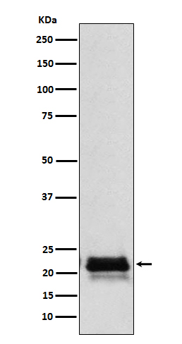 FSH beta ��FSHB�� Rabbit mAb