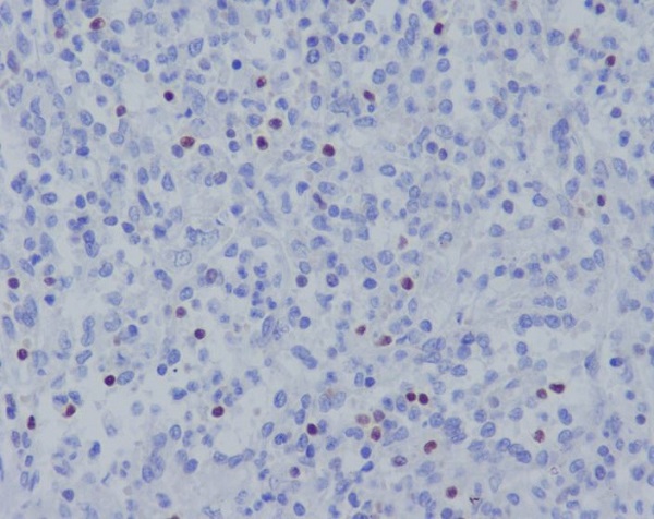 TBX21 Rabbit mAb