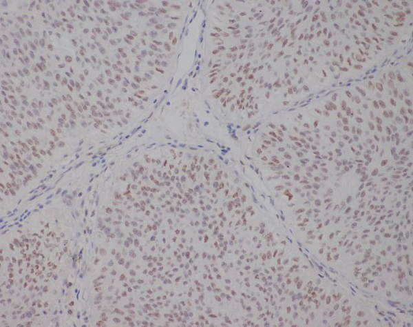 TFE3 Rabbit mAb