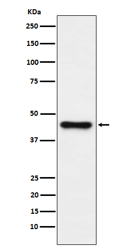 ABHD5 Rabbit mAb