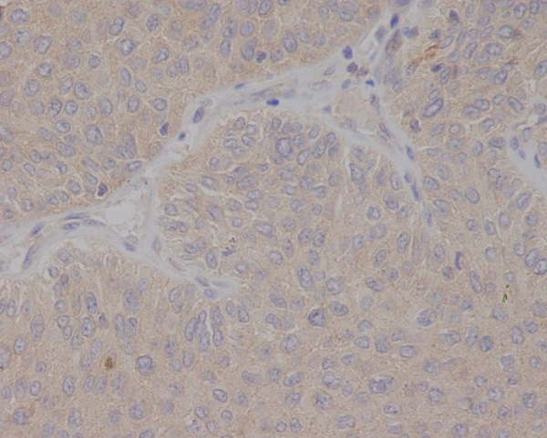 GCET2 Rabbit mAb