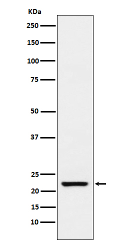 TAGLN Rabbit mAb