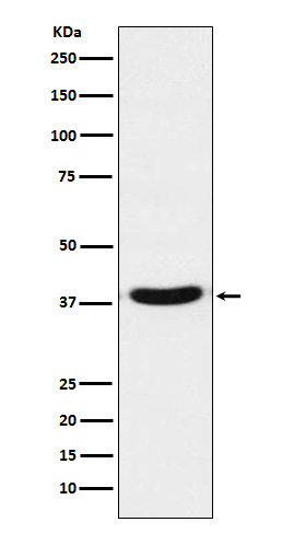 TRBP Rabbit mAb