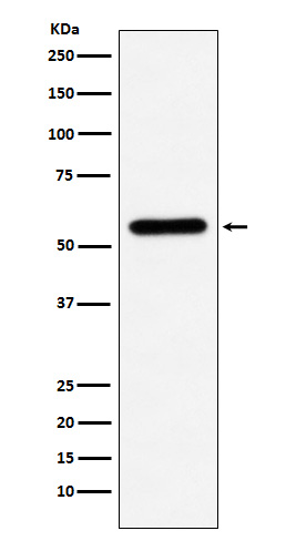 Liver Carboxylesterase 1 Rabbit mAb