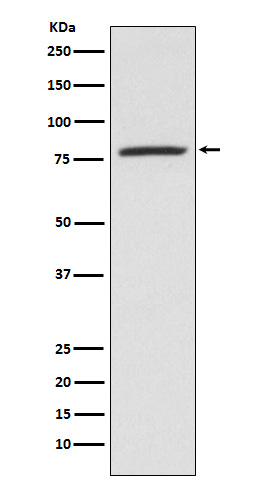 5 Lipoxygenase Rabbit mAb