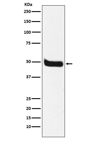 Neurokinin 1 Receptor Rabbit mAb