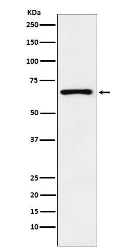 Parathyroid Hormone Receptor 1 Rabbit mAb