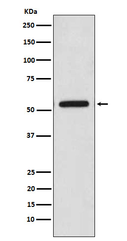 CaMKII Rabbit mAb