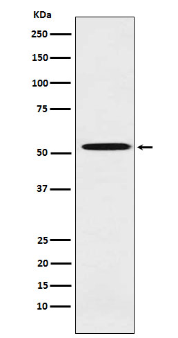 ALDH1A2 Rabbit mAb