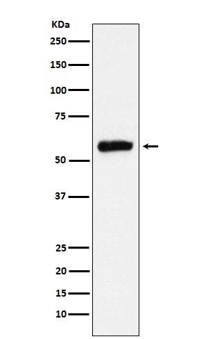 ALDH2 Rabbit mAb