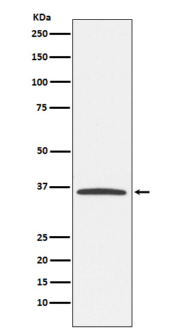 E2F6 Rabbit mAb