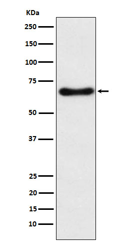 CYP24A1 Rabbit mAb