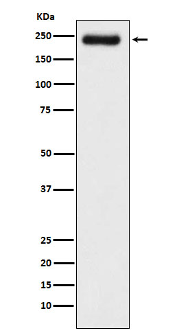 Laminin gamma 1 Rabbit mAb