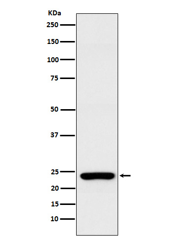 Rab25 Rabbit mAb