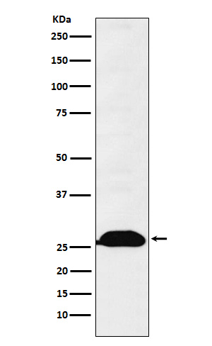 Human Kappa Chain Rabbit mAb