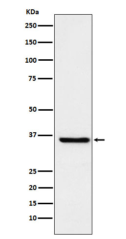 GSTO1 Rabbit mAb