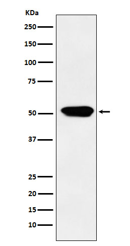 Cytochrome P450 4A Rabbit mAb