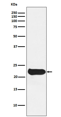 Glutathione Peroxidase 2 Rabbit mAb