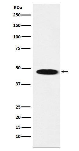 GABA A Receptor beta 1 Rabbit mAb