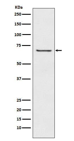 GABA A Receptor beta 2 Rabbit mAb